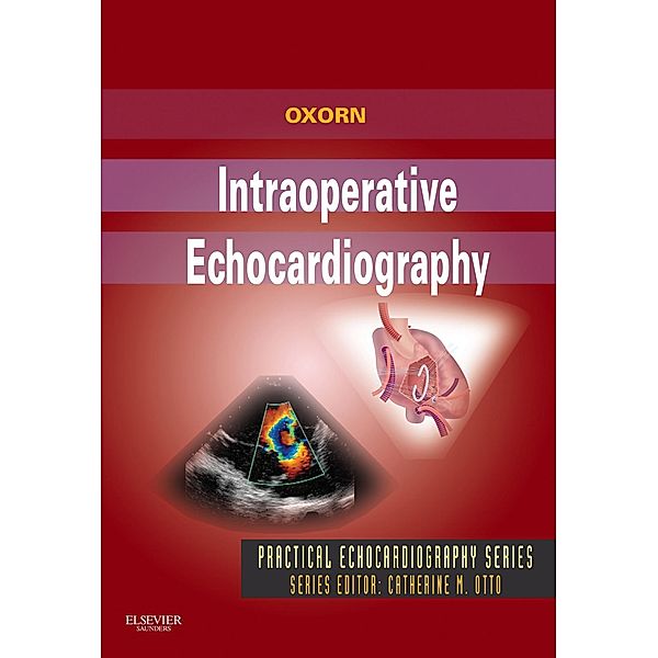 Intraoperative Echocardiography- E-BOOK, Donald Oxorn, Denise C. Joffe