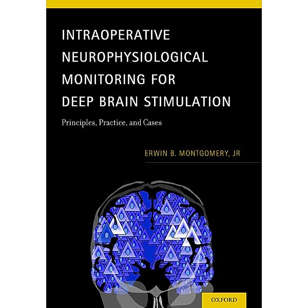 Intraoperative Neurophysiological Monitoring for Deep Brain Stimulation, Jr Montgomery