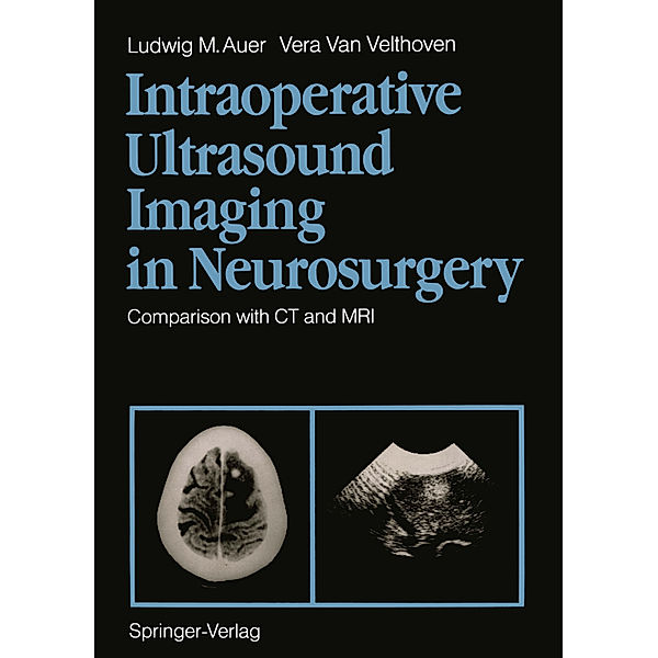 Intraoperative Ultrasound Imaging in Neurosurgery, Ludwig M. Auer, Vera Van Velthoven