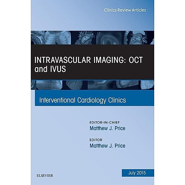 Intravascular Imaging: OCT and IVUS, An Issue of Interventional Cardiology Clinics, Matthew J. Price