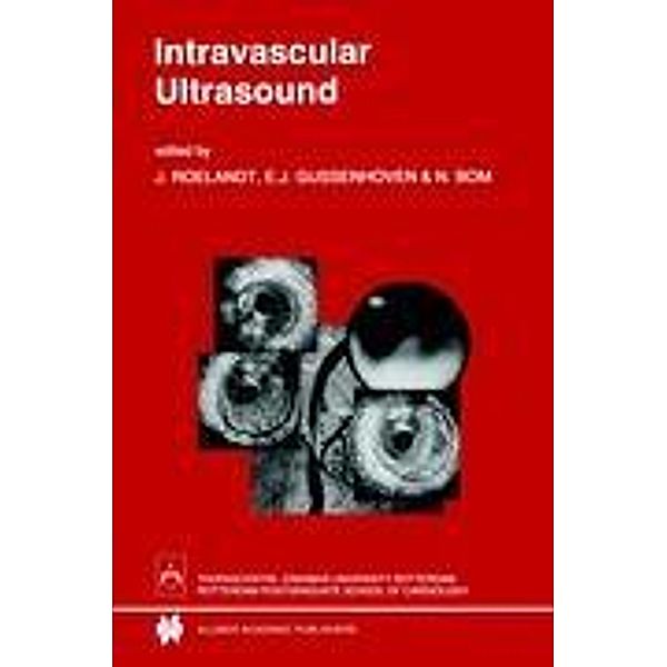 Intravascular Ultrasound