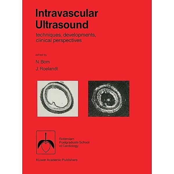 Intravascular ultrasound