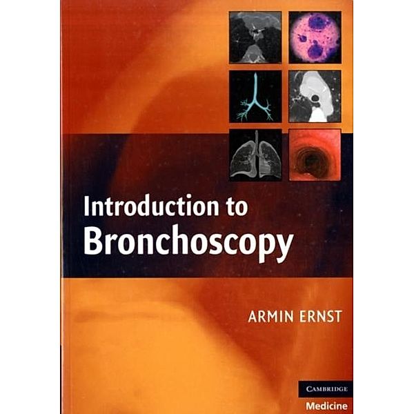 Introduction to Bronchoscopy