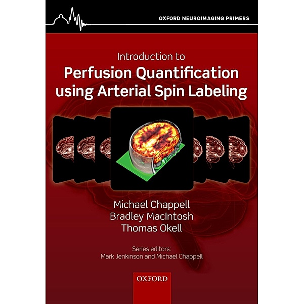 Introduction to Perfusion Quantification using Arterial Spin Labelling, Michael Chappell, Bradley Macintosh, Thomas Okell