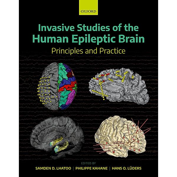 Invasive Studies of the Human Epileptic Brain