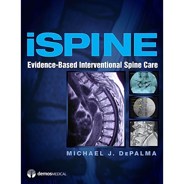 iSpine