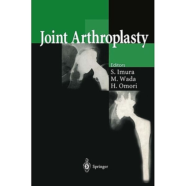 Joint Arthroplasty