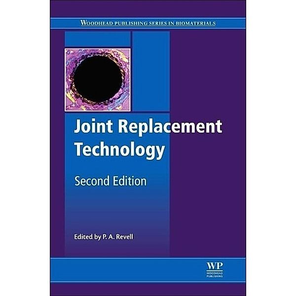 Joint Replacement Technology