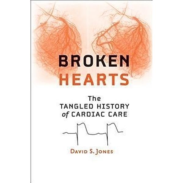 Jones, D: Broken Hearts, David S. Jones