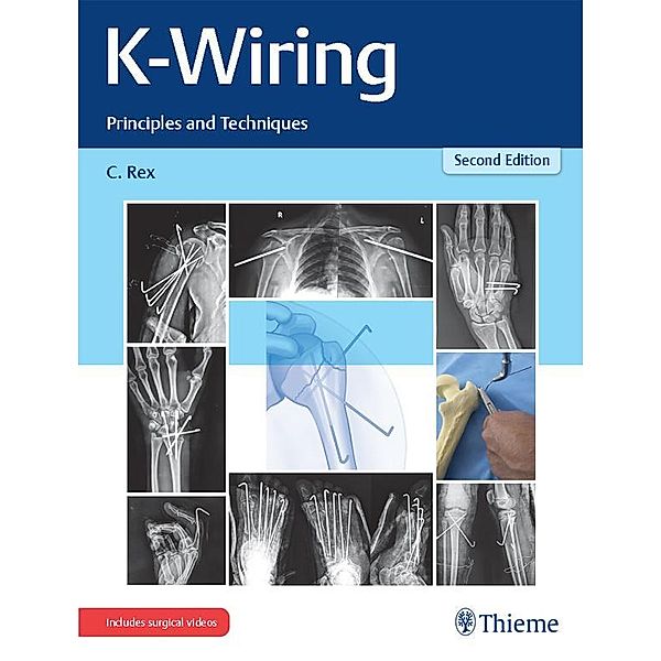 K-Wiring, C. Rex