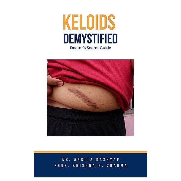 Keloids Demystified: Doctor's Secret Guide, Ankita Kashyap, Krishna N. Sharma