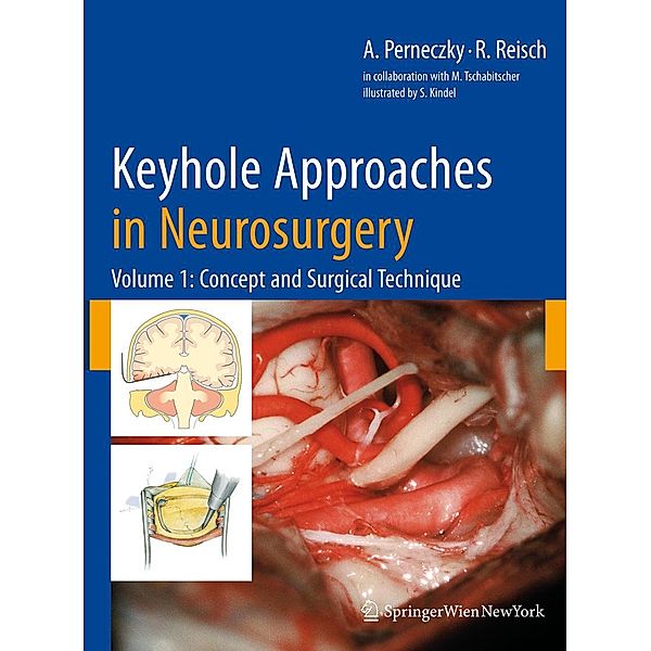 Keyhole Approaches in Neurosurgery, Axel Perneczky, Robert Reisch