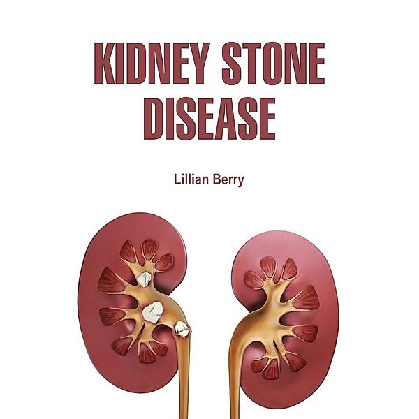 Kidney Stone Disease, Lillian Berry