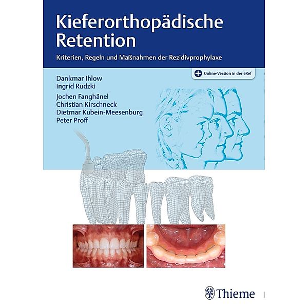 Kieferorthopädische Retention