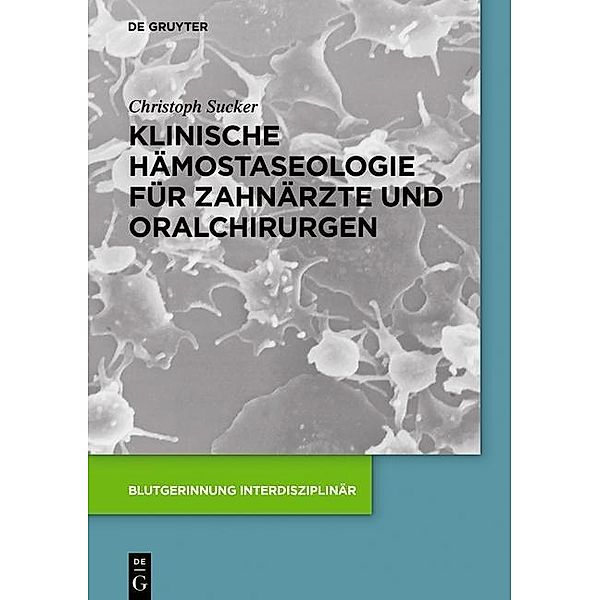 Klinische Hämostaseologie für Zahnärzte und Oralchirurgen, Christoph Sucker