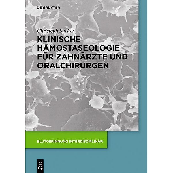 Klinische Hämostaseologie für Zahnärzte und Oralchirurgen / Blutgerinnung interdisziplinär, Christoph Sucker