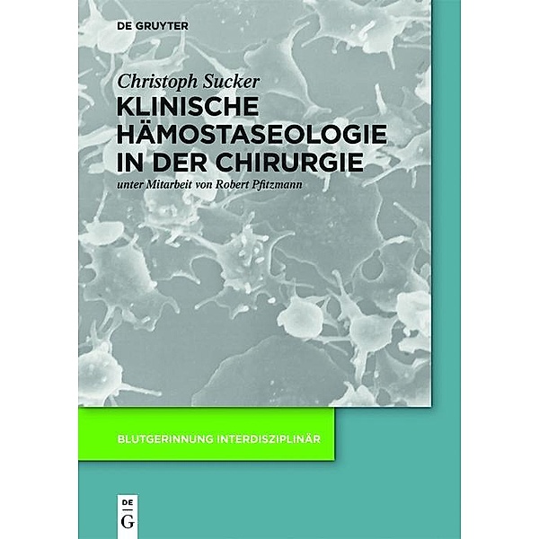 Klinische Hämostaseologie in der Chirurgie / Blutgerinnung interdisziplinär, Christoph Sucker