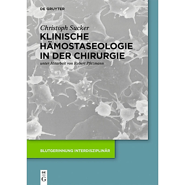 Klinische Hämostaseologie in der Chirurgie, Christoph Sucker