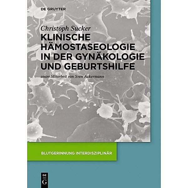 Klinische Hämostaseologie in der Gynäkologie und Geburtshilfe / Blutgerinnung interdisziplinär, Christoph Sucker