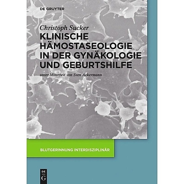 Klinische Hämostaseologie in der Gynäkologie und Geburtshilfe, Christoph Sucker