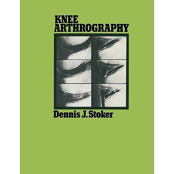 Knee Arthrography, Dennis J. Stoker