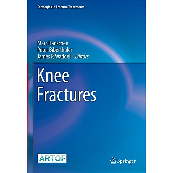 Knee Fractures / Strategies in Fracture Treatments