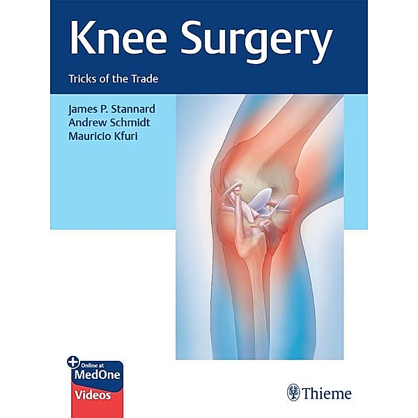 Knee Surgery, James P. Stannard, Andrew Schmidt, Mauricio Kfuri