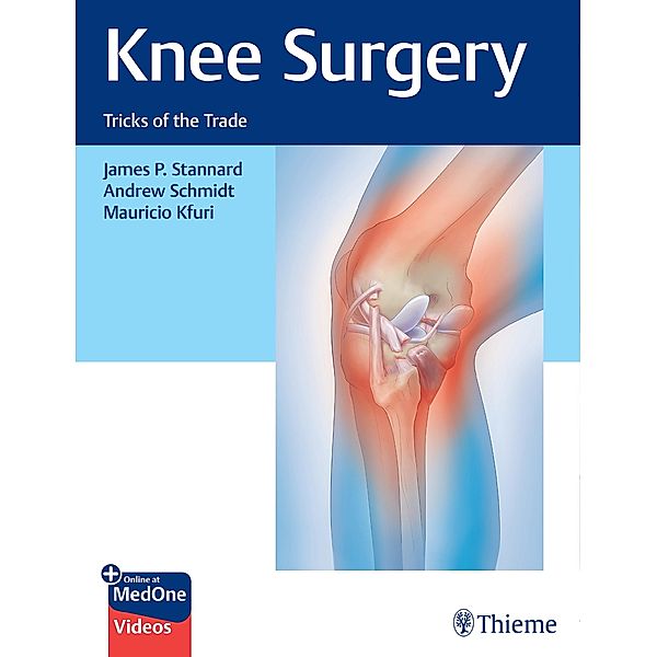 Knee Surgery, James Stannard, Andrew Schmidt, Mauricio Kfuri