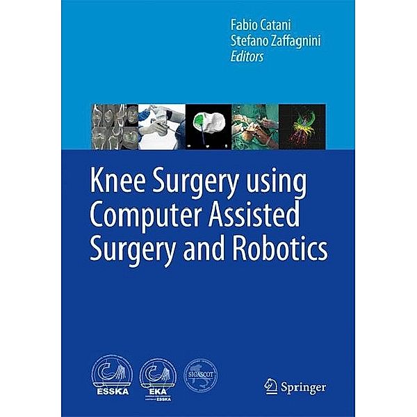 Knee Surgery using Computer Assisted Surgery and Robotics