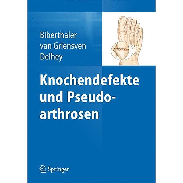 Knochendefekte und Pseudarthrosen, Peter Biberthaler, Martijn van Griensven, Patrick Delhey