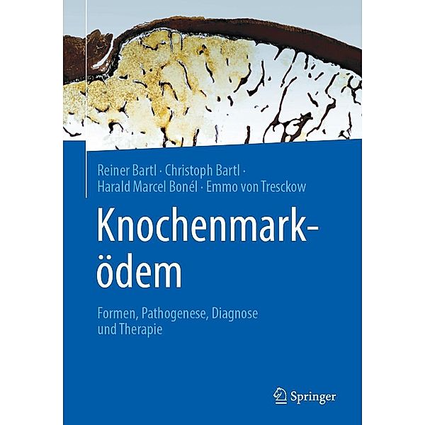 Knochenmarködem, Reiner Bartl, Christoph Bartl, Harald Marcel Bonél, Emmo von Tresckow