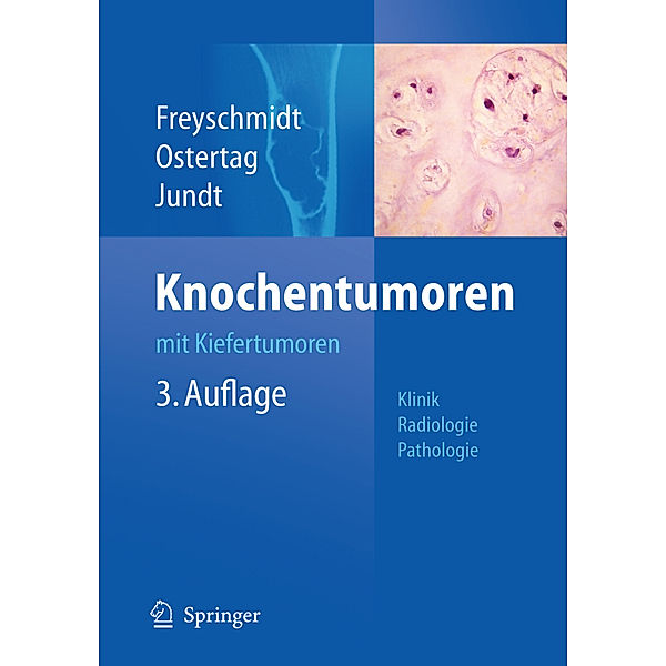 Knochentumoren mit Kiefertumoren, Jürgen Freyschmidt, Helmut Ostertag, Gernot Jundt