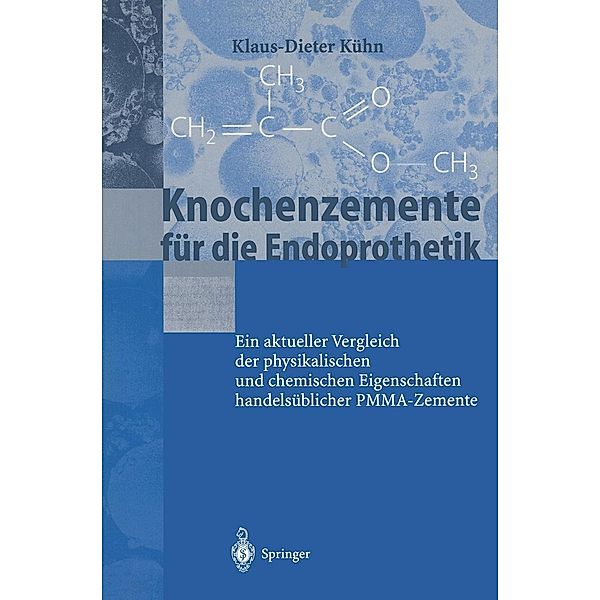 Knochenzemente für die Endoprothetik, K. -D. Kühn