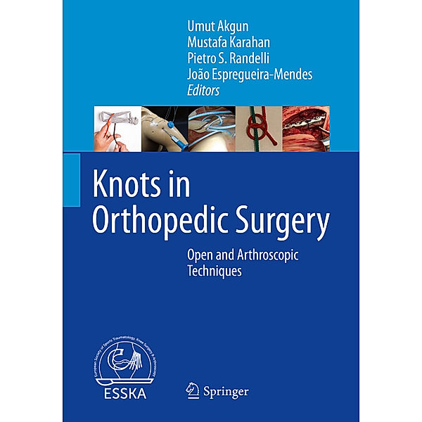 Knots in Orthopedic Surgery