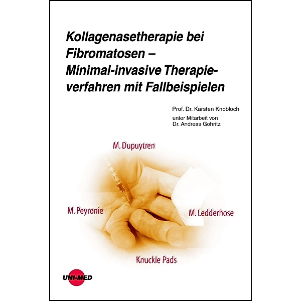 Kollagenasetherapie bei Fibromatosen - Minimal-invasive Therapieverfahren mit Fallbeispielen / UNI-MED Science, Karsten Knobloch