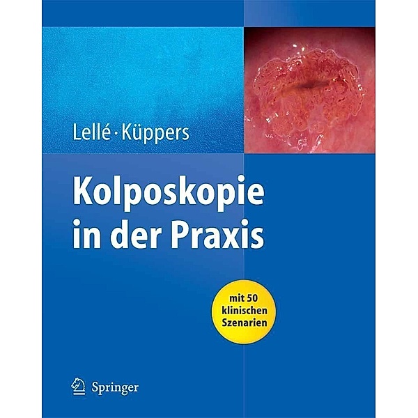 Kolposkopie in der Praxis, Ralph J. Lellé, Volkmar Küppers