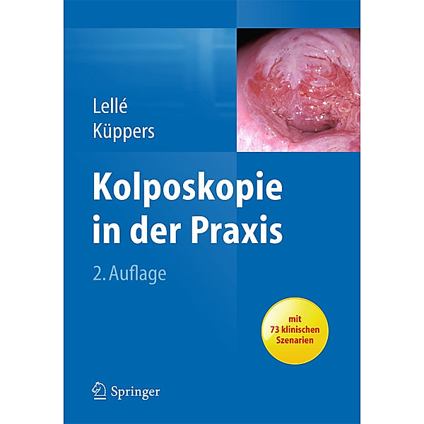 Kolposkopie in der Praxis, Ralph J. Lellé, Volkmar Küppers