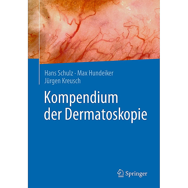 Kompendium der Dermatoskopie, Hans Schulz, Max Hundeiker, Jürgen Kreusch