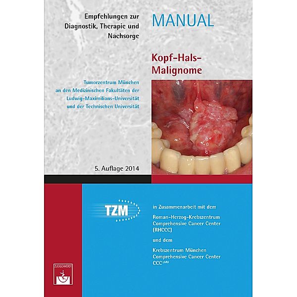 Kopf-Hals-Malignome / Manuale Tumorzentrum München