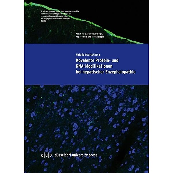 Kovalente Protein- und RNA-Modifikationen bei hepatischer Enzephalopathie, Natalia Qvartskhava