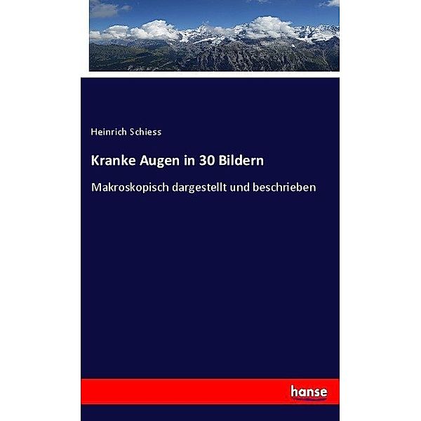 Kranke Augen in 30 Bildern, Heinrich Schiess