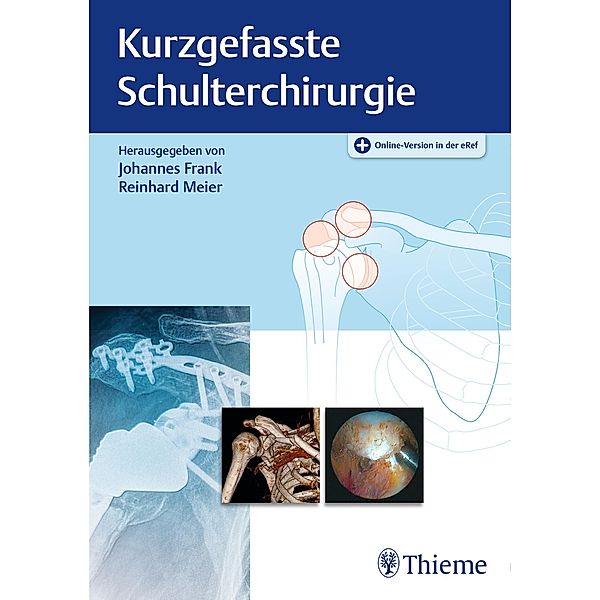 Kurzgefasste Schulterchirurgie