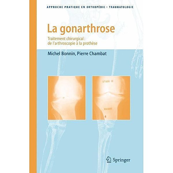 La gonarthrose / Approche pratique en orthopédie-traumatologie, Michel Bonnin, Pierre Chambat