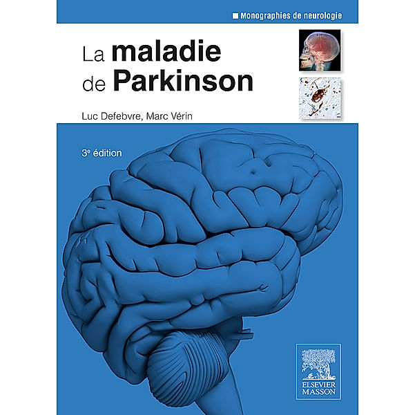 La maladie de Parkinson, Luc Defebvre, Marc Vérin