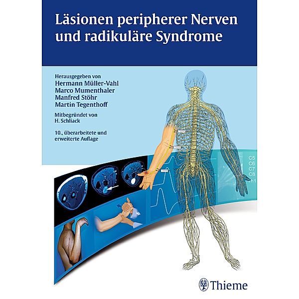 Läsionen peripherer Nerven und radikuläre Syndrome, Alexander Meng