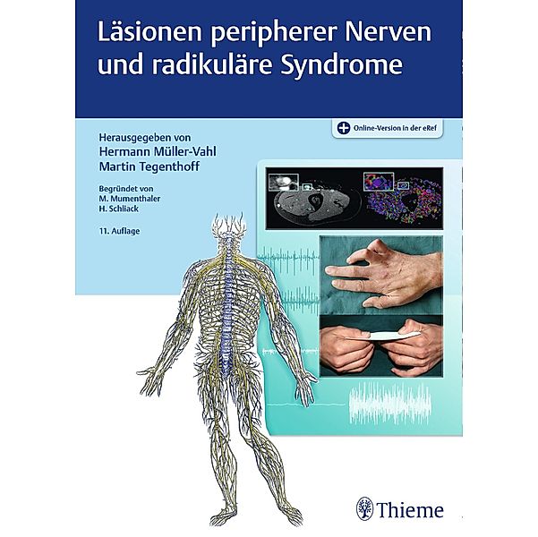 Läsionen peripherer Nerven und radikuläre Syndrome