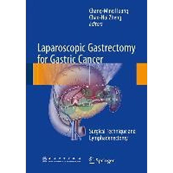 Laparoscopic Gastrectomy for Gastric Cancer
