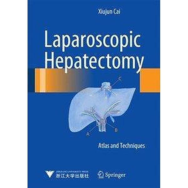 Laparoscopic Hepatectomy, Xiujun Cai