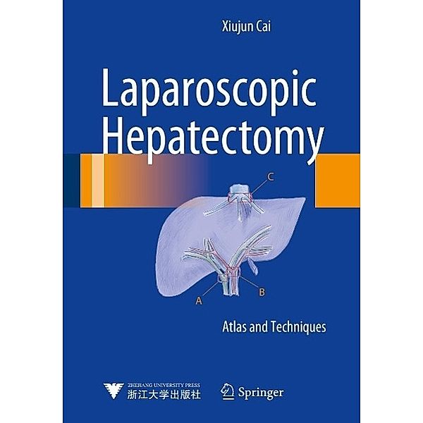 Laparoscopic Hepatectomy, Xiujun Cai