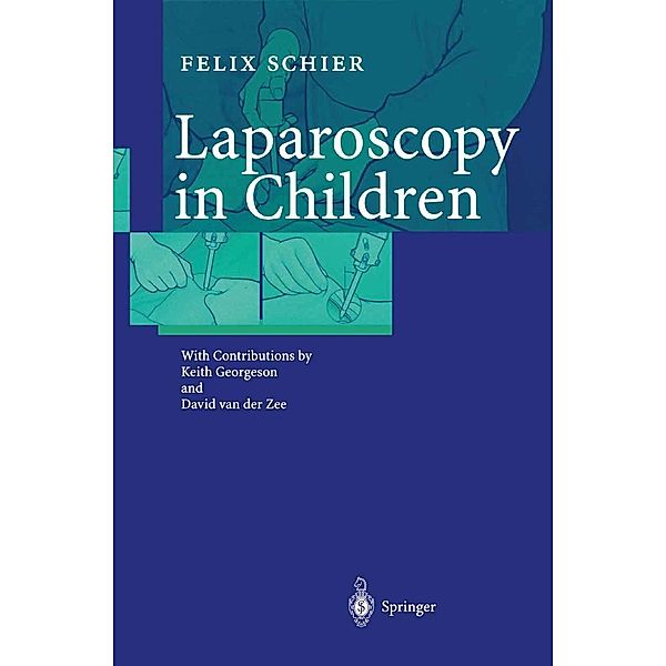 Laparoscopy in Children, Felix Schier